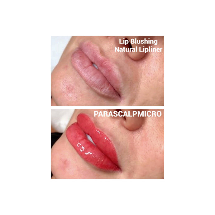 Lip Blushing & Natural Lipliner Micropigmentation Permanent Makeup Cosmetic Tattoo- PARASCALPMICRO INSTITUTE
